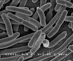 E. coli/National Institute of Allergy and Infectious Diseases (NIAID)