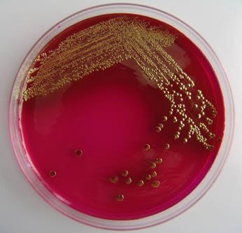 La bacteria E.Coli se hizo resistente a dos antibióticos de avanzada