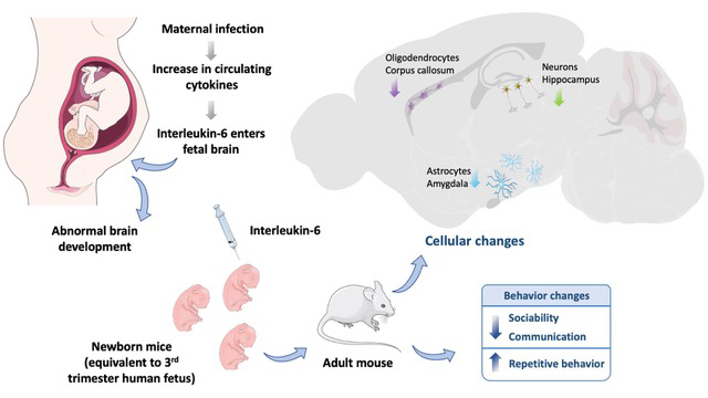 Maternal Infections that Produce the IL-6 Cytokine Increase the Risk for Neurodevelopmental Disorders