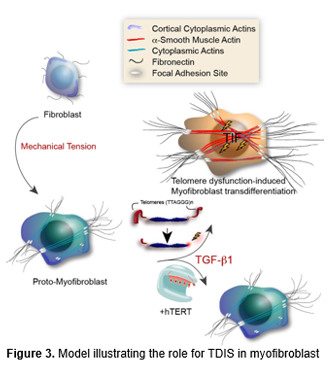 Text Box:  
Figure 3. Model illustrating the role for TDIS in myofibroblast transdifferentiation 

